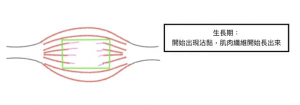 开元体育官方网站肌肉拉伤多久可以运动？(图8)